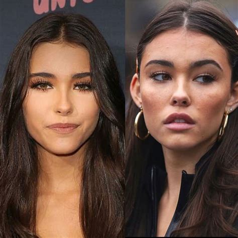 madison beer plastic surgery|Madison Beer Responds to Plastic Surgery Rumors